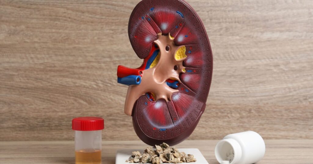 kidney symptoms, kidney image