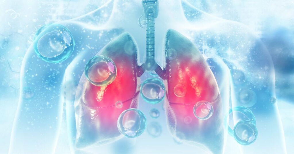 Water in Lungs - Causes, Symptoms, Treatment and Prevention