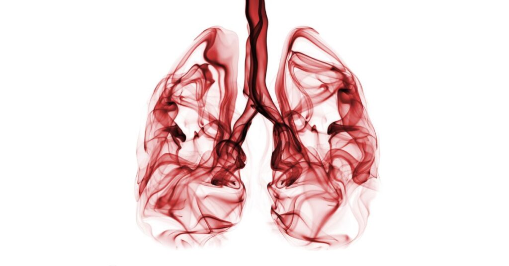 Water in Lungs - Causes, Symptoms, Treatment and Prevention